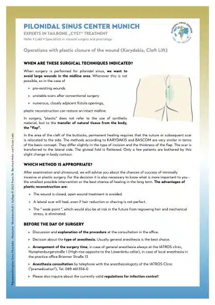 Info flyer about Karydakis surgery for sinus pilonidalis
